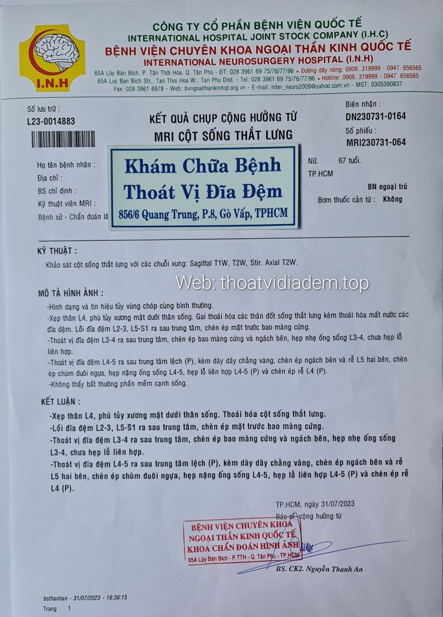 Hình ảnh kết quả chụp MRI, bị thoát vị đĩa đệm L4 L5